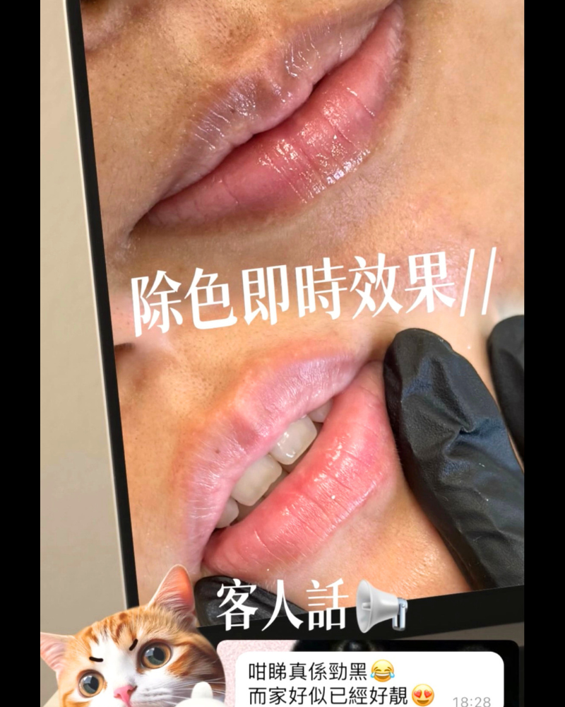 獨家唇色修復