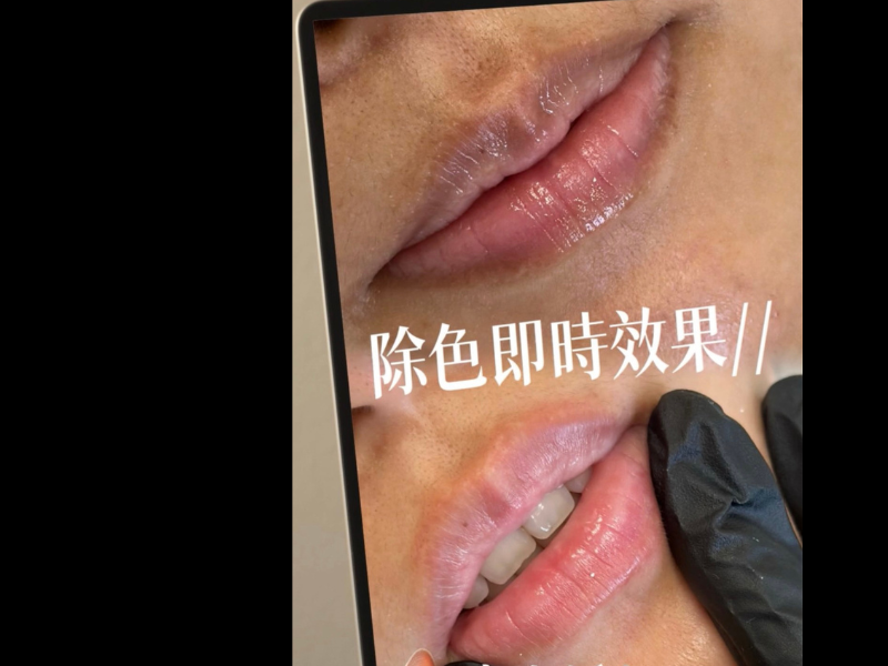 獨家唇色修復